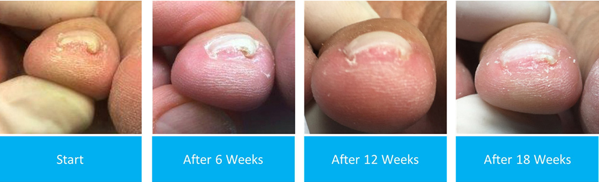 Active Ankle and Foot Care Specialist | Diabetic Foot Care, Flat Feet and Hammertoe